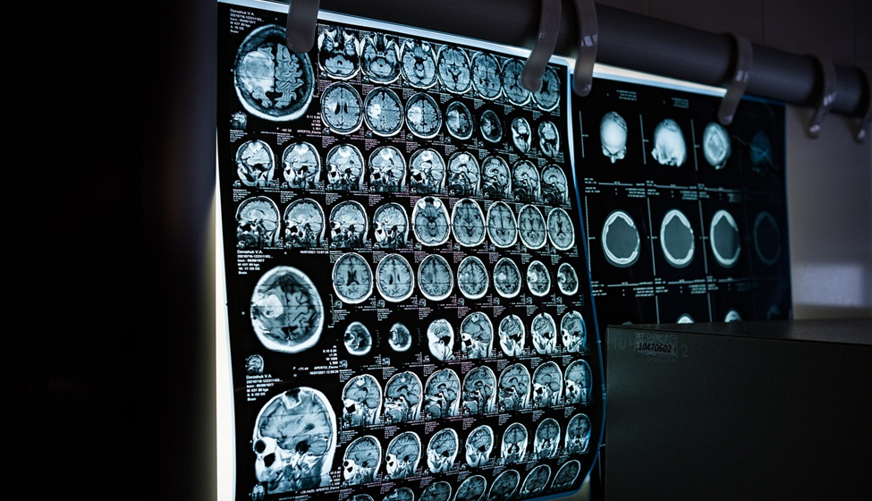How Data Visualization Helps Medical Teams Make Better Decisions